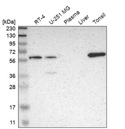 Neuregulin-1/NRG1 Antibody, Novus Biologicals 25 &mu;L; Unlabeled:Antibodies,